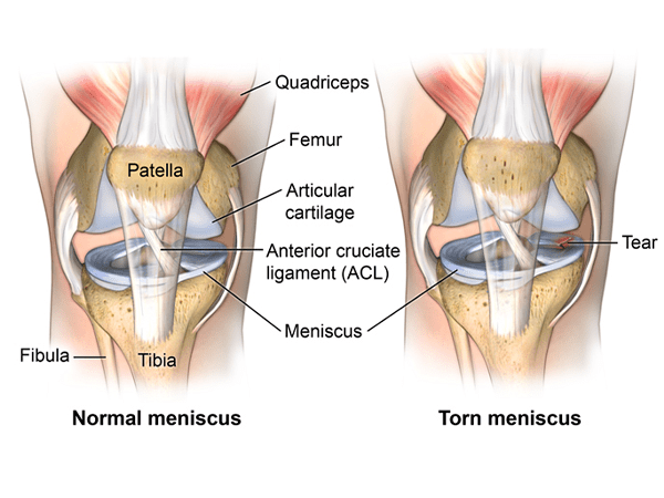 knee-meniscus